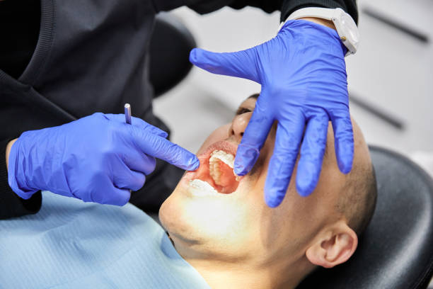 Best Emergency Broken Tooth Repair in Cumberland, MD